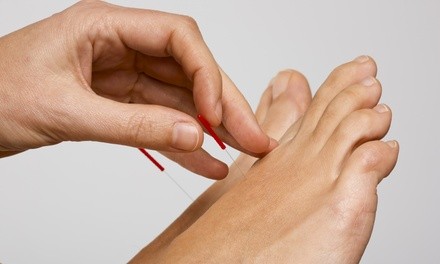 Up to 27% Off on Acupuncture Services at Tucson Acupuncture Practice