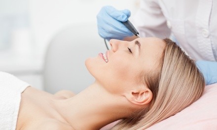 One Fibroblast Fiber Pen Session for One or Two Facial Areas at Forever Young Laser Clinic (Up to 60% Off)