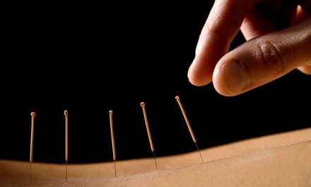 One or Three Acupuncture Treatments or Back Therapy Package at Acupuncture and Holistic Center (Up to 56% Off)