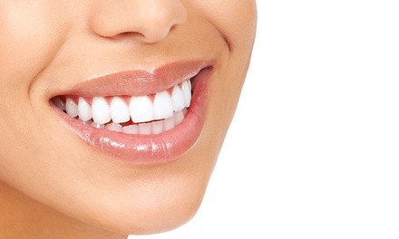 Dental Exam, X-Ray, Cleaning, Teeth Whitening, Retainer, More at United Dental Group (Up to 90% Off). 8 Options.