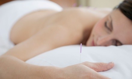 Quit Smoking or Stress-Relief Acupuncture Session with Aromatherapy at Fei Yang Acupuncture (Up to 58% Off)