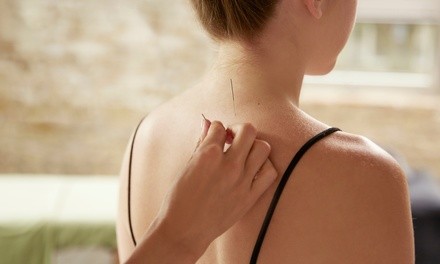 One Acupuncture Treatments at New Height Acupuncture (Up to 35% Off)