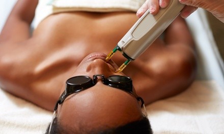 Six Laser Hair-Reduction Sessions on One Small or Extra-Small Area at Wicked Med Spa (Up to 66% Off)