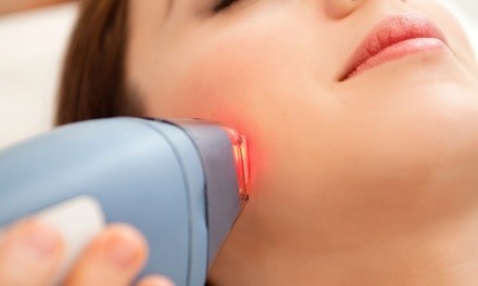 One Lumecca IPL Treatment for Full Face or Face and Neck at RegenMD (Up to 75% Off)