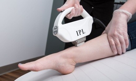 One or Two IPL Hair-Removal Sessions at BodyBrite (Up to 47% Off)