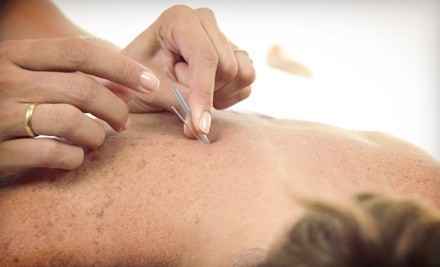 One, Three, or Five Acupuncture Sessions at Stella's Acupuncture (Up to 74% Off)