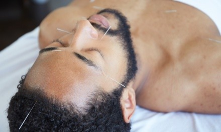 One or Three Acupuncture or Cupping Sessions at Edgebrook Chiropractic Health Center (Up to 62% OfF)
