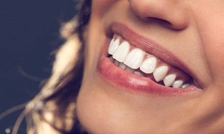 Up to 62% Off at Lone Tree Dental Associates