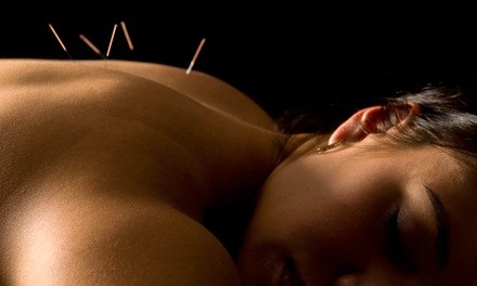 $59 for Two Acupuncture Treatments and Consultation at Acupuncture & Chinese Medicine Center ($235 Value)