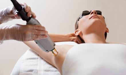 Three Laser Hair-Removal Sessions at KP Aesthetics (Up to 71% Off). Four Options Available.