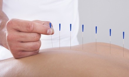 One or Three Acupuncture Treatments at Songshine Acupuncture (Up to 60% Off)