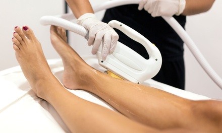 Laser Hair-Removal Sessions at The Health & Wellness Collective (Up to 92% Off). Five Options Available.