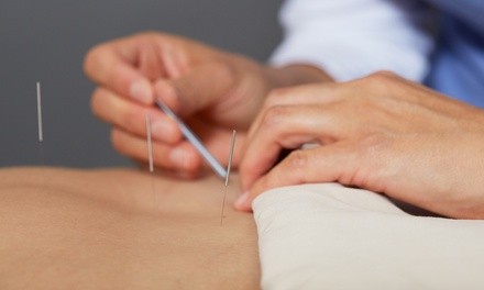 $28 for Combined Therapeutic Acupuncture and Massage Session from Richard Pope LAc, LMT ($85 Value)