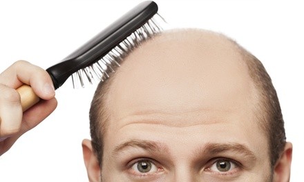 $719 for a Hair-Replacement Service with Follow-Up at I Look Good ($1,200 Value)