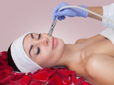 Up to 49% Off on Microdermabrasion at Fairytale Facials