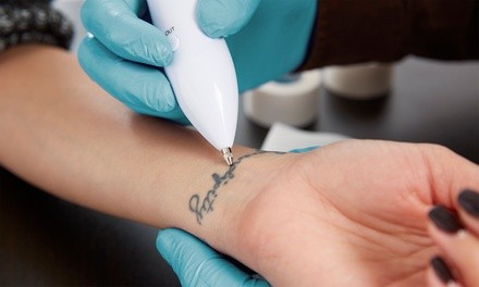 Three Tattoo Removal Sessions for Up to 3, 6, or 9 Sq. Inches at Eminence Medical Aesthetics (Up to 75% Off)