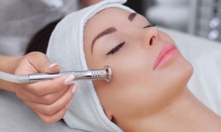 One Diamond Microdermabrasion Treatment with Optional Chemical Peel at Esthetics by Jenna (Up to 45% Off)