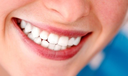 $99 for One 60-Minute Zoom! Teeth Whitening Session at Adrenity Body & Glow Studio ($150 Value)