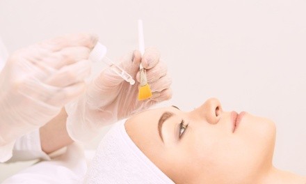 Up to 52% Off on Acne Treatment (Service) at Mocha Skin Studio