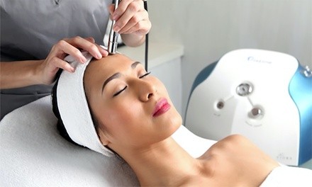 One or Three Hydrating Microdermabrasion Treatments at Look Young Be Fit (Up to 68% Off)