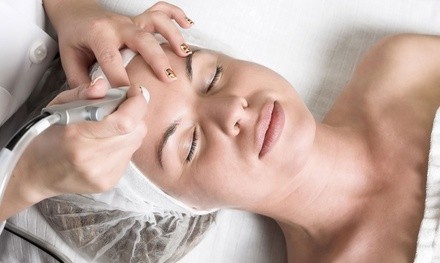 One, Four, or Six Microdermabrasion Treatments at Skinsational Advanced Skincare (Up to 65% Off)