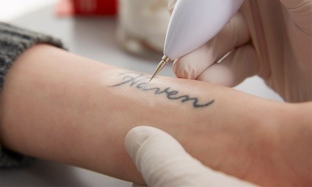 Up to 60% Off on Tattoo Removal at Pigment Tattoo & Laser Removal