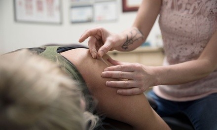 One Acupuncture Session at GL Acupuncture Wellness Center (Up to 62% Off)