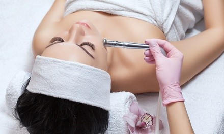 One or Three 90-Minute Diamond Microdermabrasion Facials at KalonSkin (Up to 60% Off)