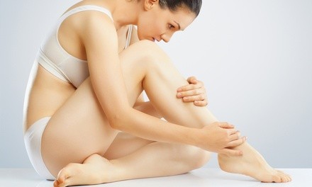 $171 for Laser Spider-Vein Removal Treatments for Both Legs at Evolution Medical Spa ($300 Value)