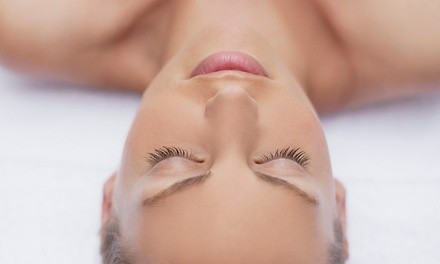 One or Three Microdermabrasion Treatments at Golla Center for Plastic Surgery (Up to 63% Off)