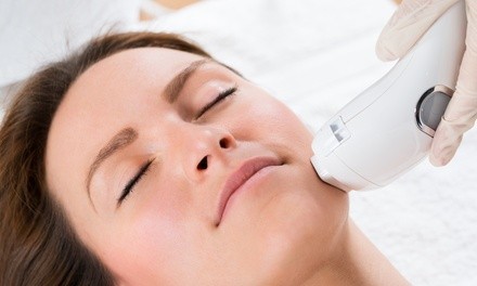 One or Two IPL Photofacials at Timeless Skin Care Laser Clinic (Up to 70% Off)