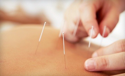 One Acupuncture Treatments with Initial Consultation at J & S Chinese Acupuncture Clinic (Up to 87% Off)