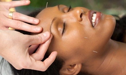 One Acupuncture Treatment at Health Atlast ( 74% Off)