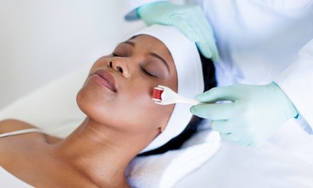 One, Two, or Four Microneedling Treatments at Permanent Makeup Arts (Up to 50% Off)