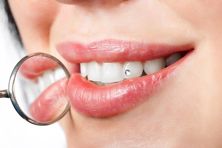 Up to 89% Off on Teeth Whitening - In-Office - Branded (Zoom, Brite Smile) at BrightSmiles Galore
