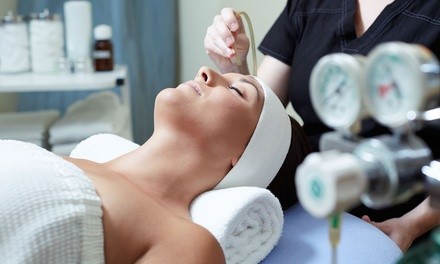 $43 for One Microdermabrasion Treatment and Chemical Peel at Bellissimo You ($135 Value) 