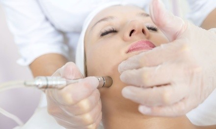 Microdermabrasion Treatment with Optional Add-Ons at Aesthetic Rejuvenation Center (Up to 63% Off)