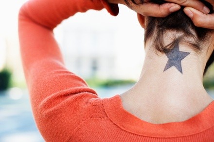 Up to 52% Off on Tattoo Removal at gentle