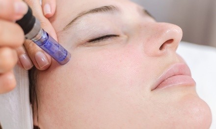 $136 for One Medical-Grade Microneedling Treatment at LIV Beautiful ($199 Value)