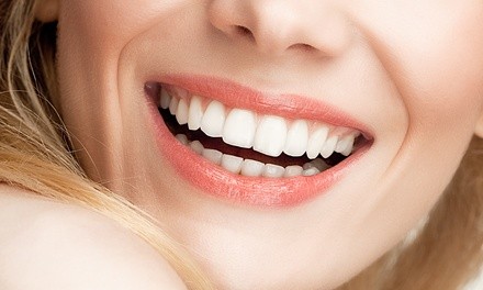 One 30- or 60-Minute Bright White Zoom Whitening Treatment at Cosmo Med Spa & Salon (65% Off)