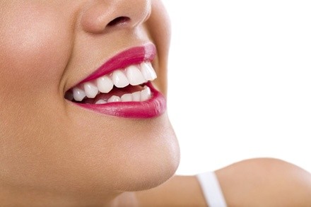 Up to 20% Off on Teeth Whitening - In-Office - Branded (Zoom, Brite Smile) at Body By SNJ