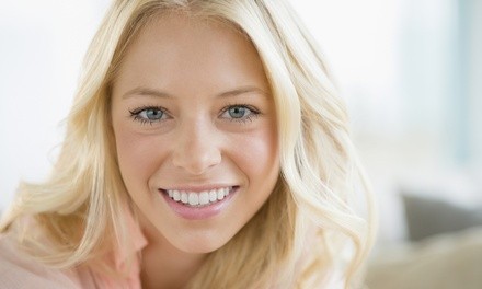 Beaming White Teeth Whitening Treatment for One or Two at Versace Hair Studio (Up to 59% Off)