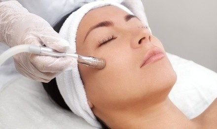 One, Two, or Four Diamond Microdermabrasion Treatments w/ LED Light Therapy at Pink Diamond Spa (Up to 63% Off)