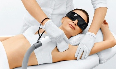 Laser Hair-Removal Sessions at Allure De Vie Salon & Day Spa (Up to 93% Off). Ten Options Available.