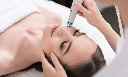 Diamond Glow Microdermabrasion Facial with Optional Cryo Eye Lift at Body Rock Sculpting Med Spa (Up to 30% Off)