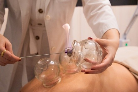 Up to 76% Off on Acupuncture Services at Luna Body And Mind