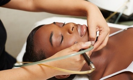 One Microdermabrasion Treatments at Salon Harmony West (Up to 43% Off)