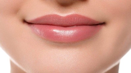 One or Two Lip Flips at Beyouty Med Spa (Up to 57% Off)