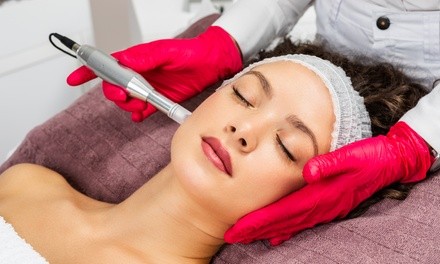 One Custom Microneedling Session with Optional PRP Treatment at  Advantage Health (Up to 40% Off)