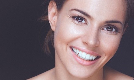 $53.50 for Teeth Whitening Treatment at Body Beautiful Laser Medical Spa ($149 Value)